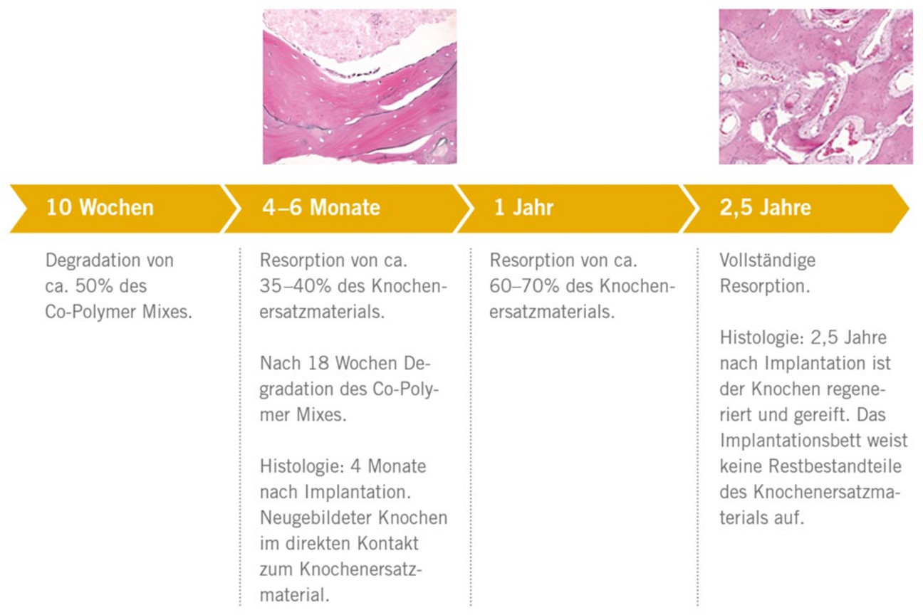 BIS_SemOss_B_resoprtionsprofil_1K