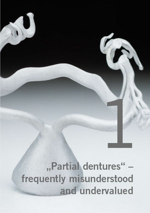 Partial dentures – frequently misunderstood and undervalued, Part 1