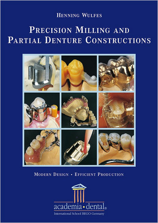 Precision Milling and Partial Denture Constructions – Modern Design and Efficient Production