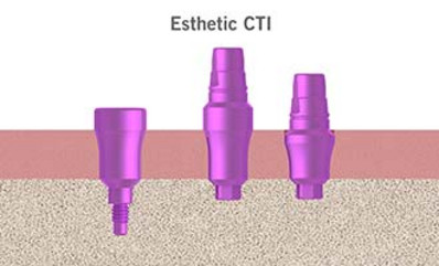 img-400_abformung-05