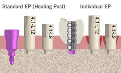 img-400_abformung-06