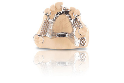 std_pic_SLM-Modellguss_1K