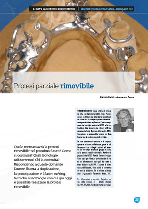Protesi parziale rimovibile, Il nuovo laboratorio odontotecnico, Vincenzo Liberati