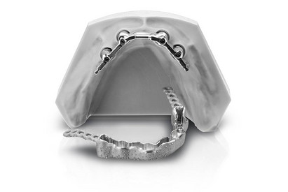 MED_std_bild_1K_Doppelkronen-Hybrid-Fertigung-2