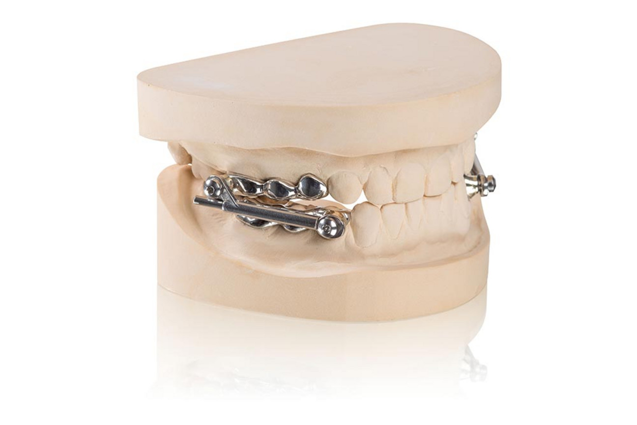 Orthodondic appliances