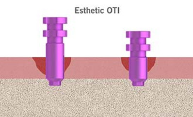 img-400_abformung-04