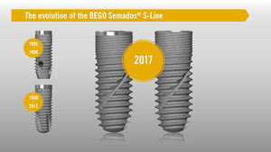 The evolution of the BEGO Semados® S-Line