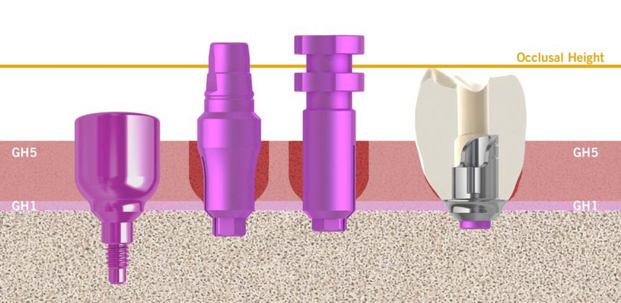 Mischformen-unterschiedlicher-Workflow-02_EN