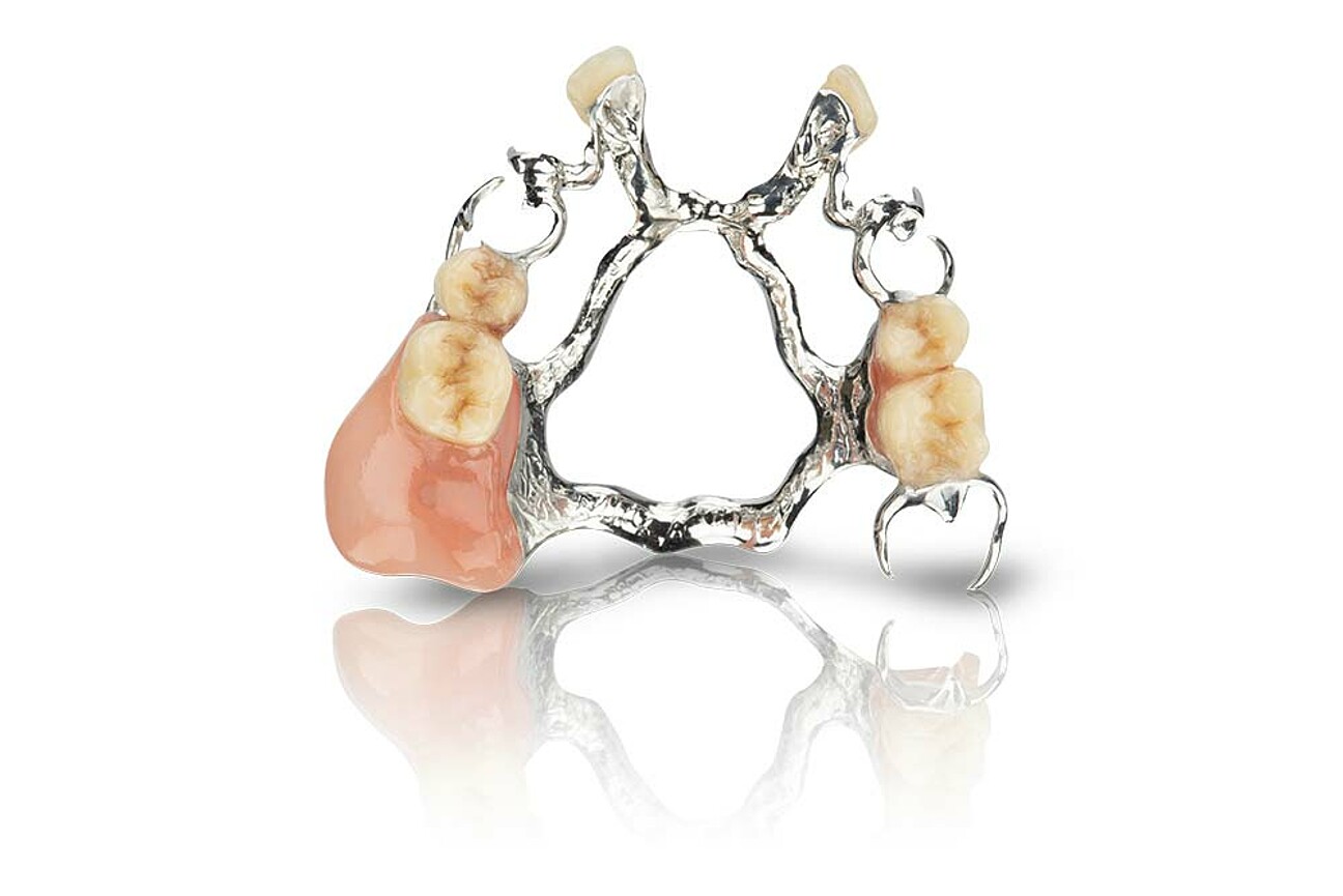 Mediloy® RPD – The non-precious alloy for the additive production of partial denture frameworks