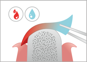 BIS_naturesQues_ColTect-P_Hand-Hapt_2