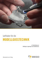 Leitfaden für die Modellgusstechnik