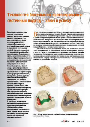 Investment materials for model casting in the dental laboratory