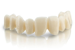 BEGO Zirkon ST /BEGO Zirkon ST Multi – Supertransluzentes Zirkoniumdioxid für großspannige Restaurationen