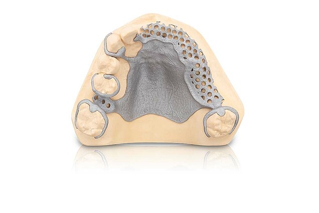 Mediloy® RPD partial denture frameworks for upper jaw – polished and blasted