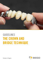 Guidelines – The Crown and Bridge Technique