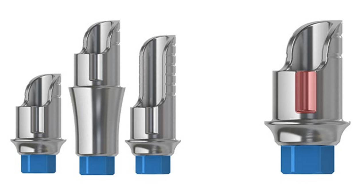 img-400_finaleVersorgung-verschraubt-02