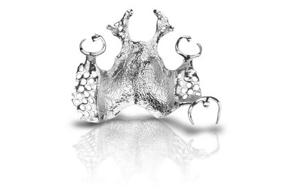 SLM manufactured partial denture frameworks made of WIRONIUM<sup>®</sup> RP