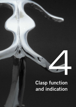 Partial dentures – Clasp function and indication, Part 4