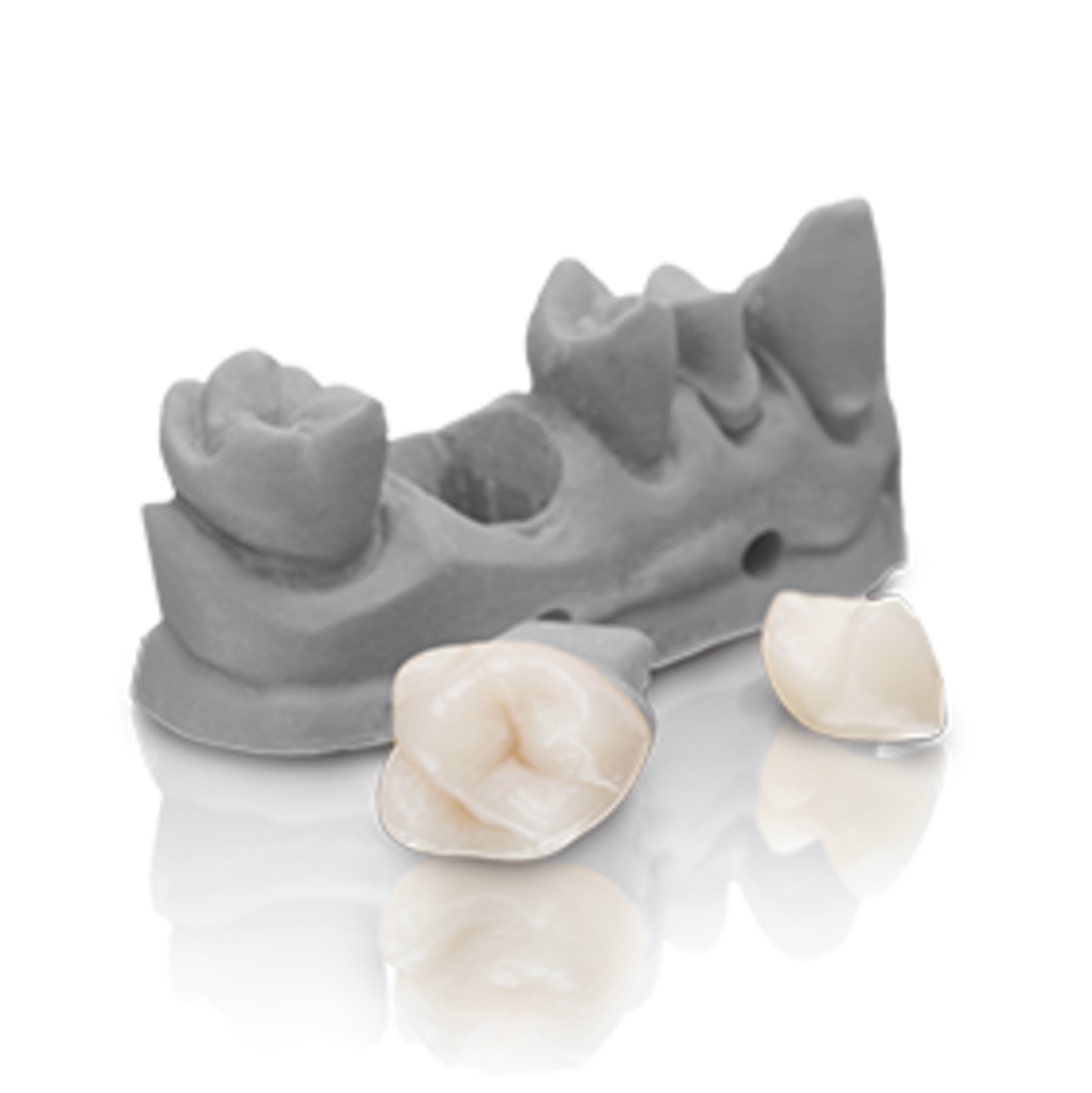 VarseoSmile Crown plus