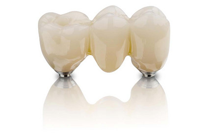 BEGO-Zirkon-ST-Multi-Bruecke-IMG_7352-Kopie