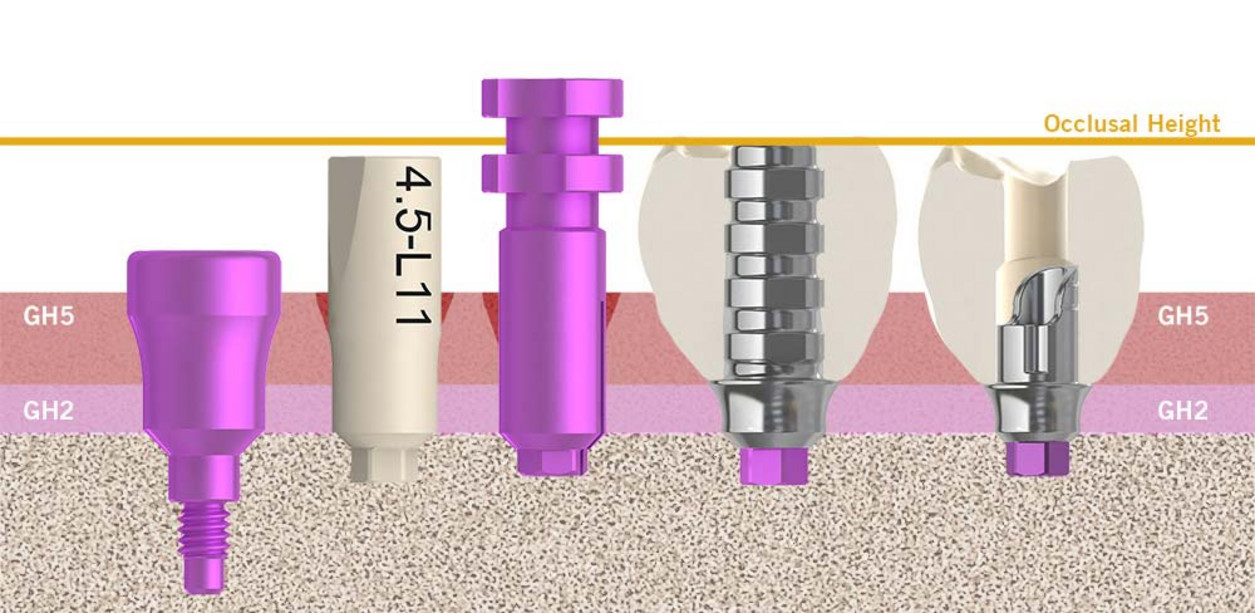 Mischformen-unterschiedlicher-Workflow-01_EN