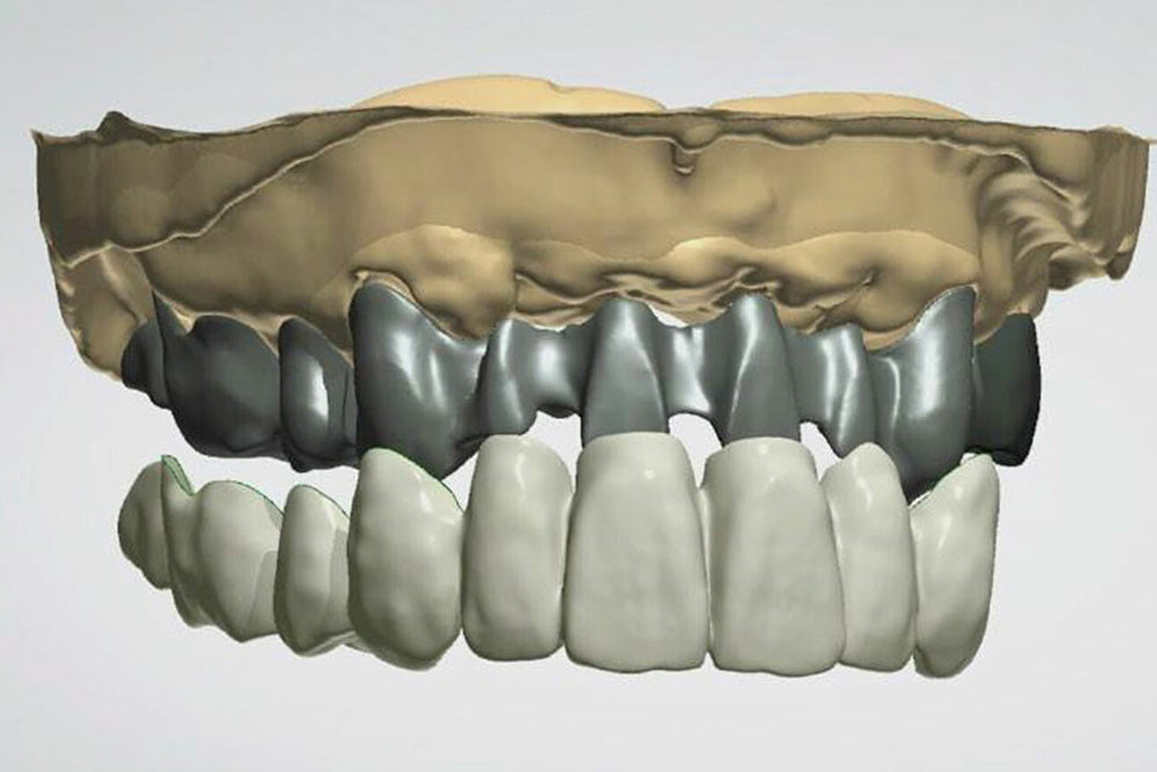 std_1K_SmartVeneering_Alles-in-einem-Design