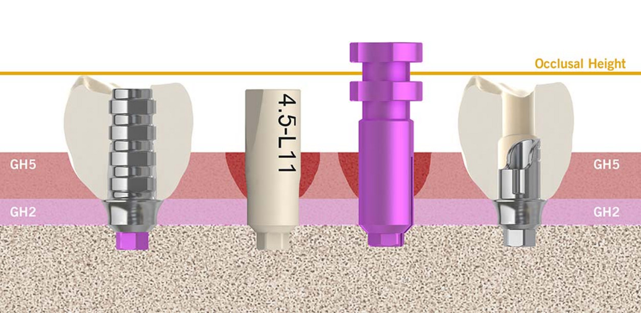 img700_prothetischer-workflow-02_EN