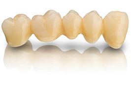 MED_std_bild_1K_BEGO-Zirkon-LT