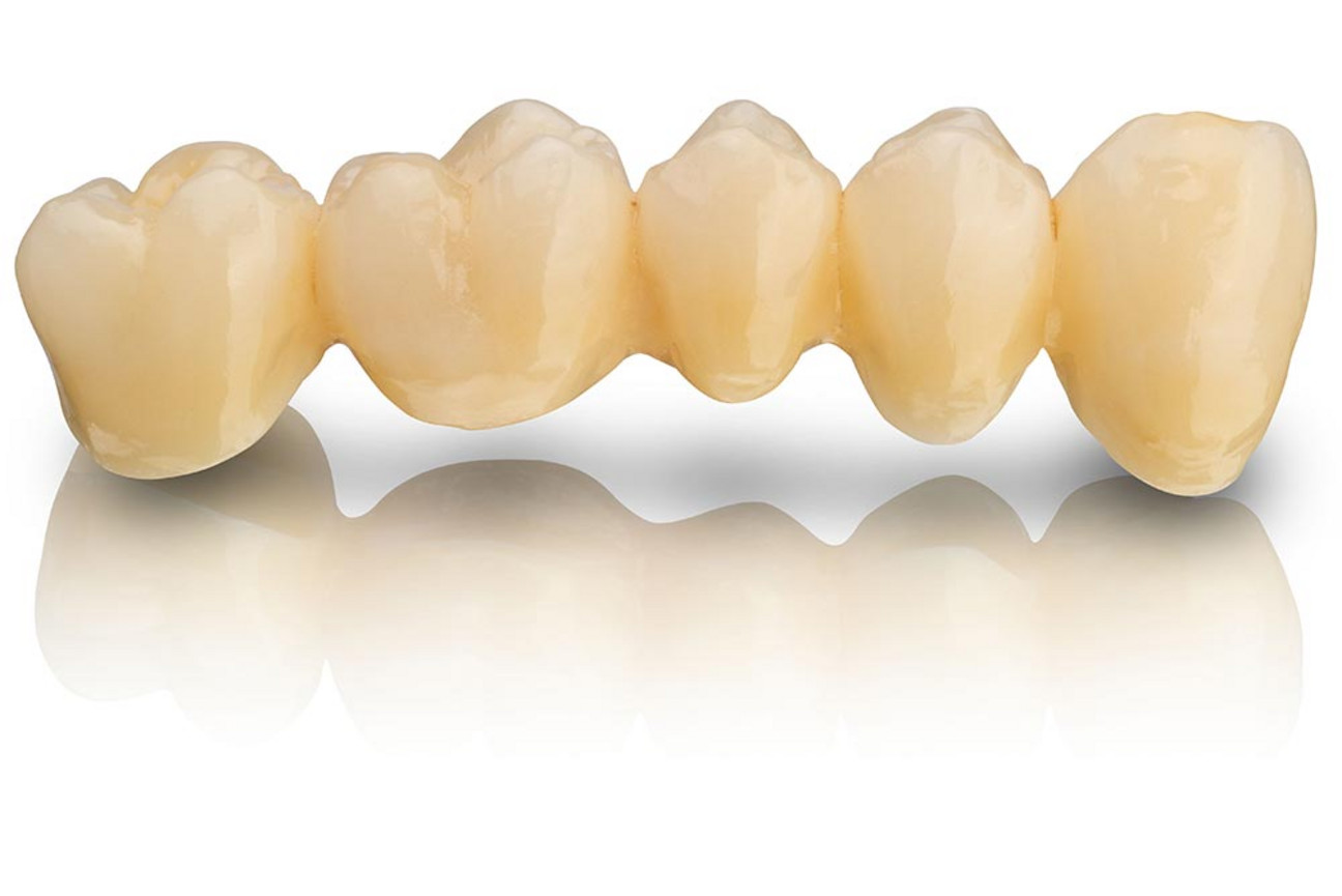 MED_std_bild_1K_BEGO-Zirkon-LT