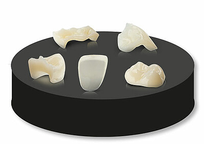 VarseoSmile® TriniQ® is excellently suited for the precise and aesthetically appealing fabrication of inlays, onlays, tabletops, and veneers, allowing you to fulfill individual patient desires