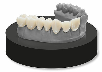 For up to seven-unit temporary bridges: VarseoSmile ®TriniQ ®is also ideal for temporary restorations, including longer bridges, providing you with flexibility in treatment planning and execution
