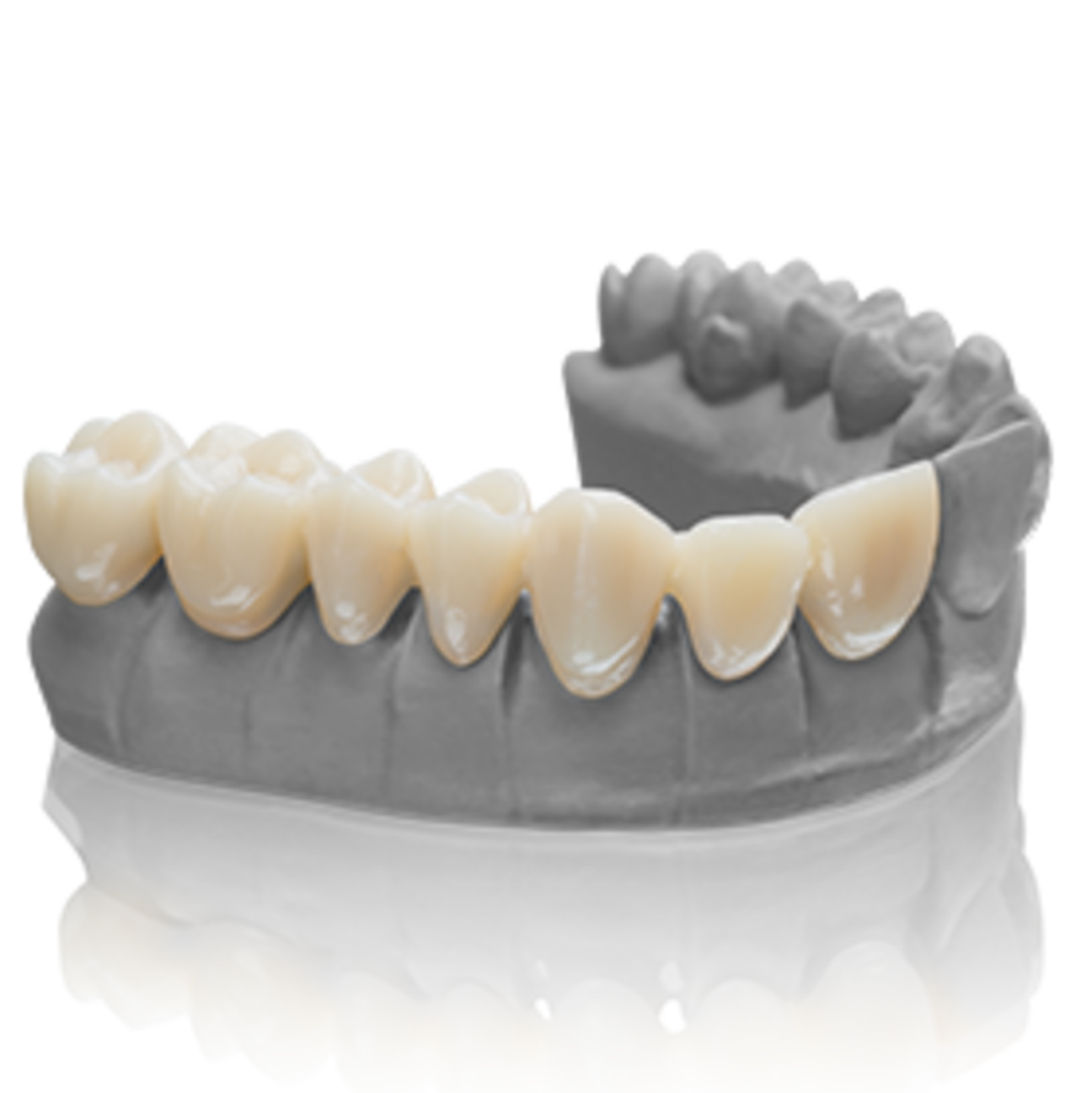 imgIndikationen_3D-Druck-start_140x140_SmileTemp-gray