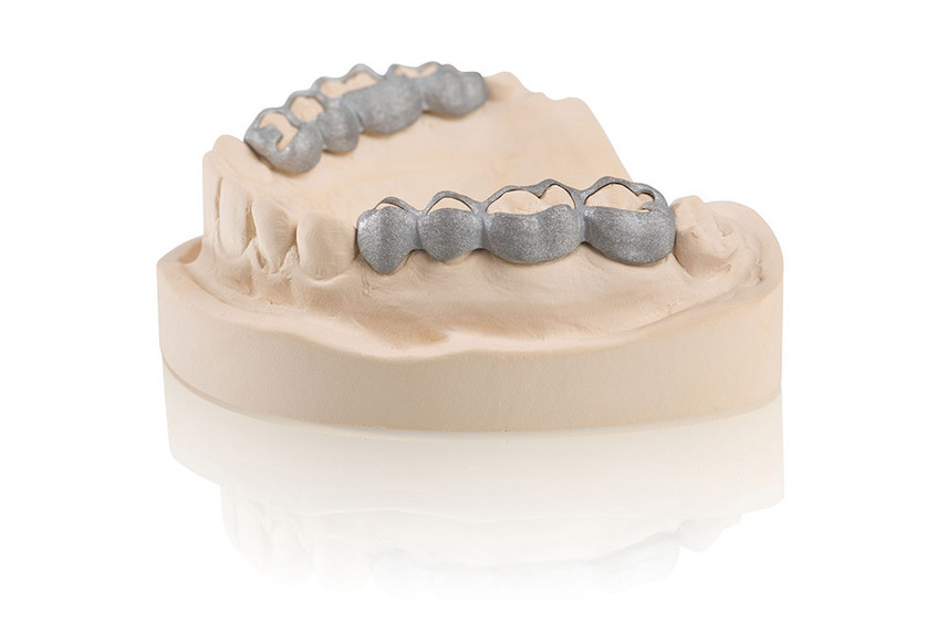 Orthodondic appliances– SLM produced