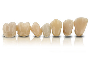 Laboratory customers can now benefit from the option of ordering 3D printed permanent restorations in seven colors from BEGO.