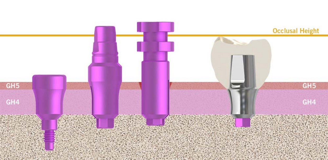 img700_prothetischer-workflow-01_EN