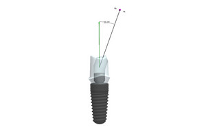 BEGO bietet abgewinkelte Schraubenkanäle für einteilige Einzelzahnversorgungen an, bei denen die Ausrichtung des Schraubenzugangskanals innerhalb der prothetischen Versorgung von 0° bis 20° zur Implantatposition individuell wählbar ist. (Bild © BEGO)