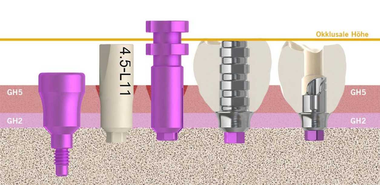 Mischformen-unterschiedlicher-Workflow-01_DE