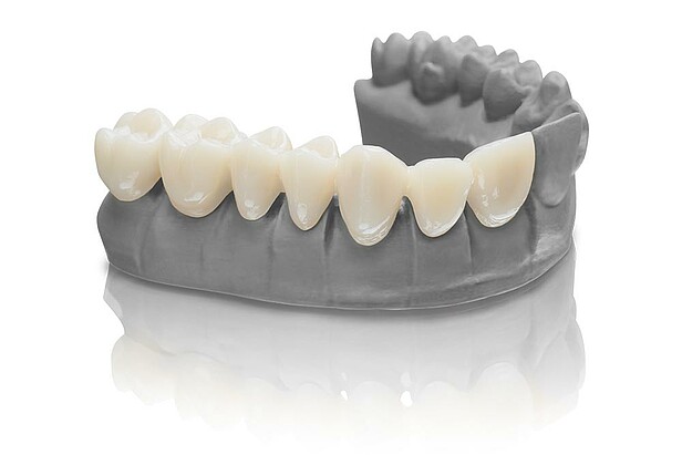 VSTQ_std-img_1K_02_VarseoSmileTemp-Bleach-auf-ModelGray