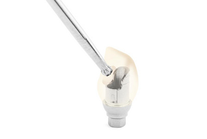 58529-Klebebasis-mit-Krone-IMG_9334