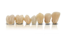 VarseoSmile Crown plus – Tooth-colored, ceramic-filled hybrid material for permanent restoration of individual teeth 