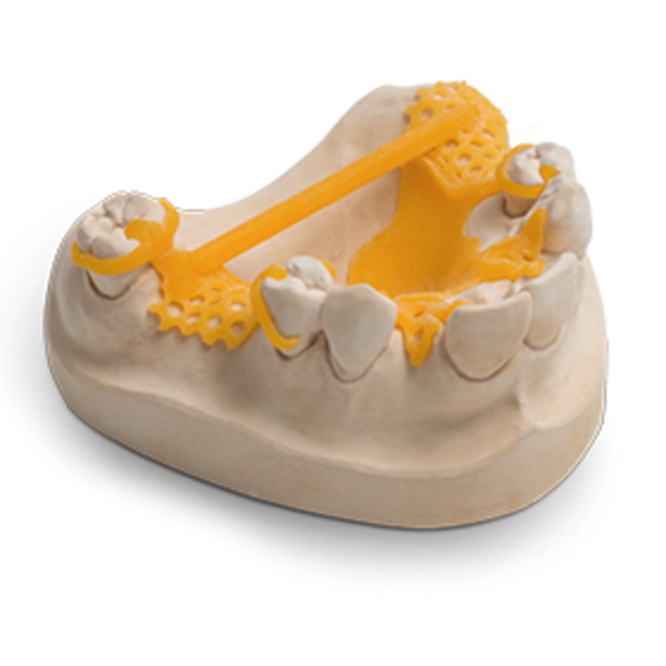 imgIndikationen_3D-Druck-start_140x140_CAD-Cast