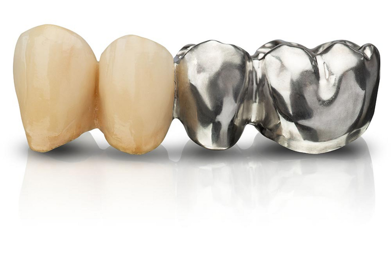 MED_std_bild_1K_Wirobond-M-plus