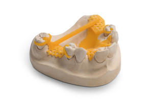 Partial denture frame made of VarseoWax CAD/Cast. Produced with the BEGO Varseo 3D printer, and ready for investment and casting in just a few steps.