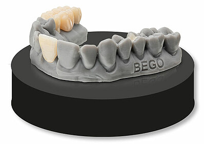 VarseoSmile ®TriniQ ®is ideal for the fabrication of single-tooth restorations, combining high material stability with aesthetically pleasing restorations at a competitive price